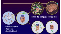 terapia innovativa nel mieloma multiplo