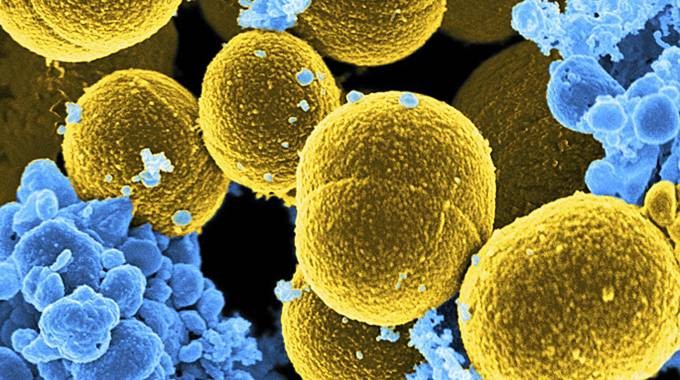 Resistenza agli antibiotici, batteri più forti